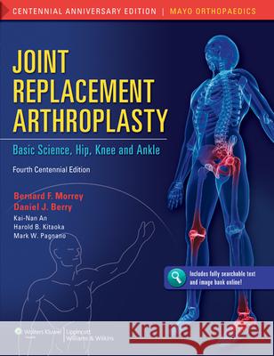 Joint Replacement Arthroplasty: Basic Science, Hip, Knee, and Ankle Volume 2 Morrey, Bernard F. 9781608314706