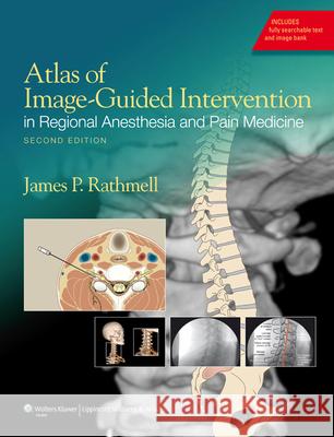 Atlas of Image-Guided Intervention in Regional Anesthesia and Pain Medicine James Rathmell 9781608317042 LIPPINCOTT WILLIAMS & WILKINS