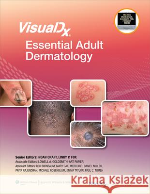 Visualdx: Essential Adult Dermatology Goldsmith, Lowell A. 9781608318056 0