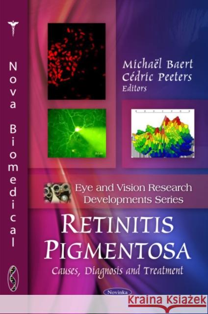 Retinitis Pigmentosa: Causes, Diagnosis & Treatment Michaël Baert, Cédric Peeters 9781608768844 Nova Science Publishers Inc