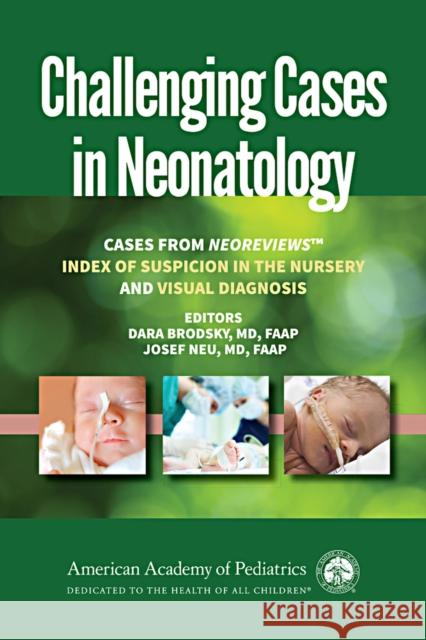 Challenging Cases in Neonatology: Cases from Neoreviews Index of Suspicion in the Nursery and Visual Diagnosis Brodsky, Dara 9781610021401 American Academy of Pediatrics