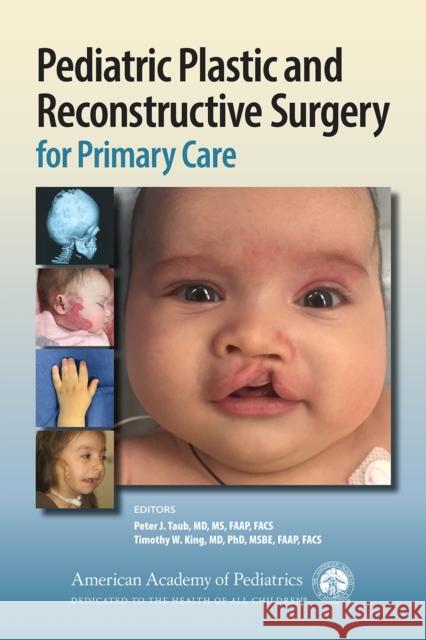 Pediatric Plastic and Reconstructive Surgery for Primary Care Peter J. Taub Timothy W. King American Academy of Pediatrics (Aap) 9781610023948 American Academy of Pediatrics