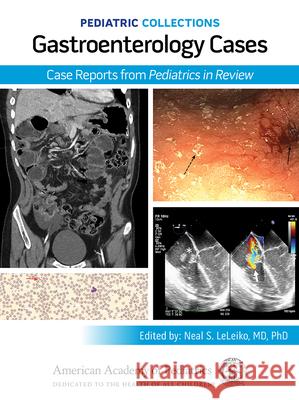 Pediatric Collections: Gastroenterology Cases: Case Reports from Pediatrics in Review American Academy of Pediatrics (Aap) 9781610027717 American Academy of Pediatrics