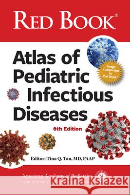 Red Book Atlas of Pediatric Infectious Diseases American Academy of Pediatrics (Aap)     Tina Q. Tan 9781610028226 American Academy of Pediatrics
