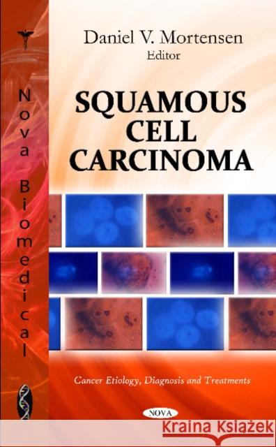 Squamous Cell Carcinoma Daniel V. Mortensen 9781612099293 Nova Science Publishers Inc