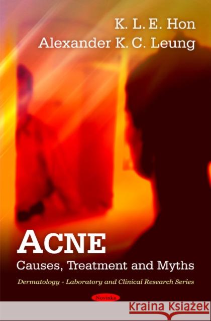 Acne: Causes, Treatment & Myths Alexander K C Leung, K I E Hon 9781616682583 Nova Science Publishers Inc
