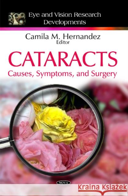 Cataracts: Causes, Symptoms, & Surgery Camila M Hernandez 9781616689551 Nova Science Publishers Inc