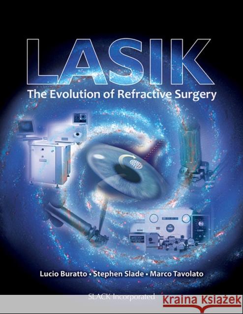 LASIK: The Evolution of Refractive Surgery Buratto, Lucio 9781617110429 Slack