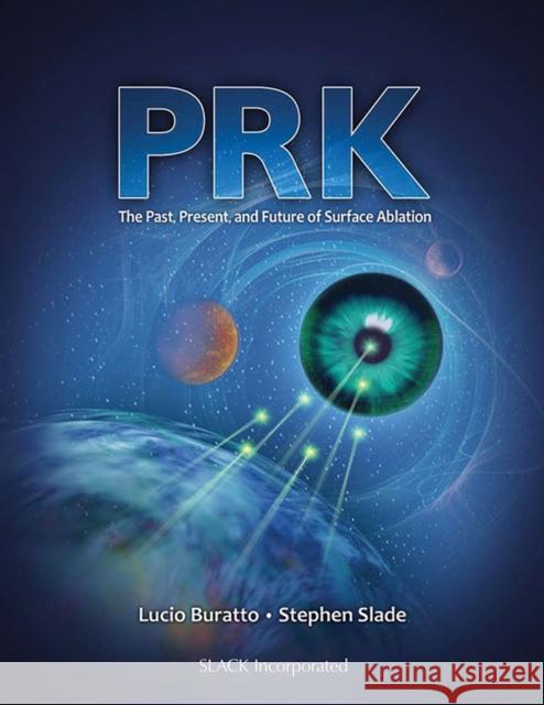 PRK: The Past, Present, and Future of Surface Ablation Buratto, Lucio 9781617110436 Slack