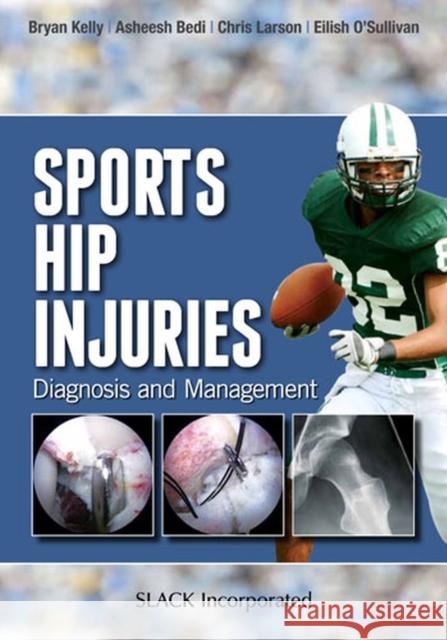 Sports Hip Injuries: Diagnosis and Management Bryan Kelly Asheesh Bedi Chris Larson 9781617110467 Slack