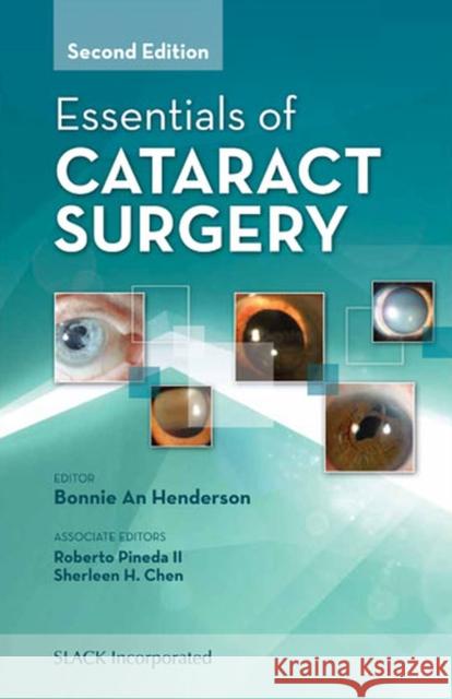 Essentials of Cataract Surgery Bonnie An Henderson 9781617110672 Slack