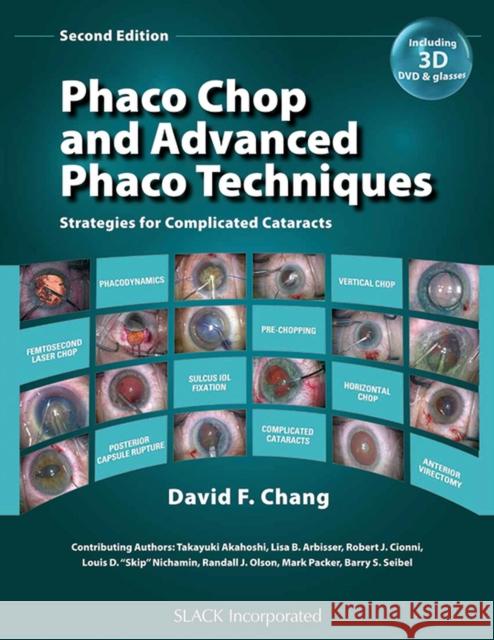 Phaco Chop and Advanced Phaco Techniques: Strategies for Complicated Cataracts [With DVD] Chang, David F. 9781617110757