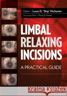 Limbal Relaxing Incisions: A Practical Guide Louis D. Nichamin 9781617118388 Slack