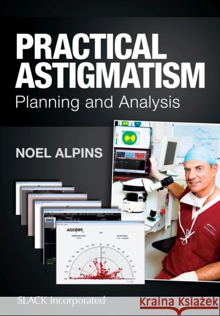 Practical Astigmatism: Planning and Analysis Noel Alpins 9781617119958 Slack