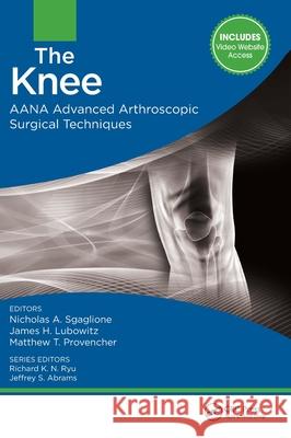 The Knee: Aana Advanced Arthroscopic Surgical Techniques Nicholas A. Sgaglione James H. Lubowitz Matthew Provencher 9781617119996