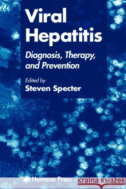 Viral Hepatitis: Diagnosis, Therapy, and Prevention Specter, Steven 9781617370335