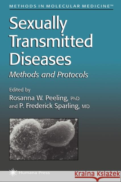 Sexually Transmitted Diseases Rosanna Peeling P. Frederick Sparling 9781617370649 Springer