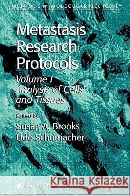 Metastasis Research Protocols Susan A. Brooks Udo Schumacher 9781617370960 Springer