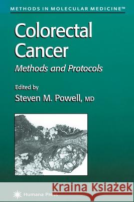 Colorectal Cancer: Methods and Protocols Powell, Steven M. 9781617371790