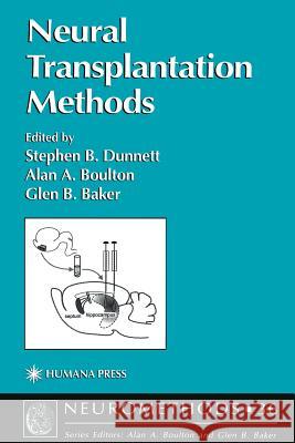 Neural Transplantation Methods Stephen B. Dunnett Alan A. Boulton Glen B. Baker 9781617371912 Springer