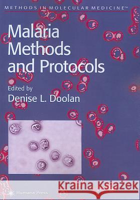 Malaria Methods and Protocols Denise L. Doolan 9781617372056