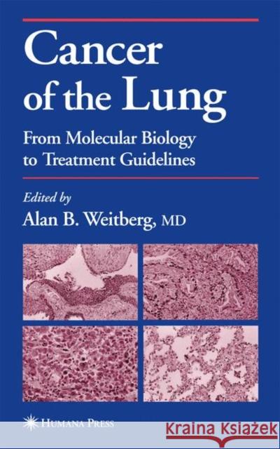 Cancer of the Lung: From Molecular Biology to Treatment Guidelines Weitberg, Alan 9781617372094 Springer