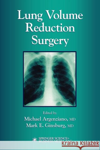 Lung Volume Reduction Surgery Michael Argenziano Mark E. Ginsburg 9781617372209 Springer
