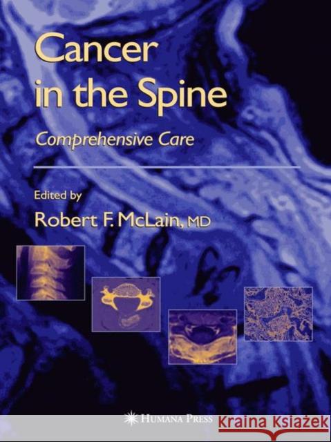 Cancer in the Spine: Comprehensive Care McLain, Robert F. 9781617373404 Springer