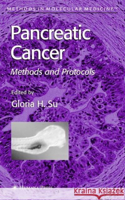 Pancreatic Cancer: Methods and Protocols Su, Gloria H. 9781617373626 Springer