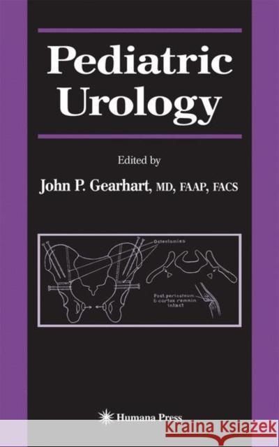 Pediatric Urology John P. Gearhart 9781617373640 Springer