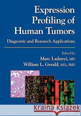 Expression Profiling of Human Tumors: Diagnostic and Research Applications Ladanyi, Marc 9781617373756 Springer