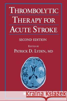 Thrombolytic Therapy for Acute Stroke Patrick D. Lyden 9781617375408 Springer