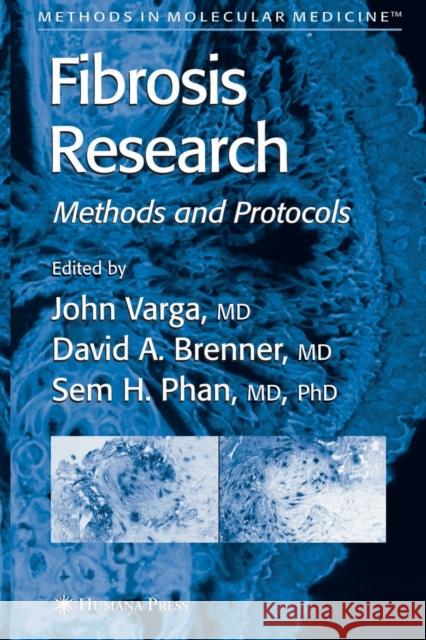 Fibrosis Research: Methods and Protocols Varga, John 9781617375927 Springer