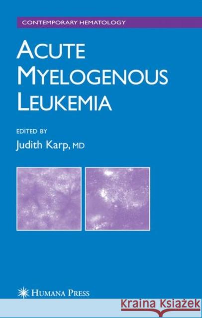 Acute Myelogenous Leukemia Judith E. Karp 9781617376757 Springer