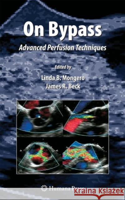 On Bypass: Advanced Perfusion Techniques Mongero, Linda B. 9781617376870 Springer