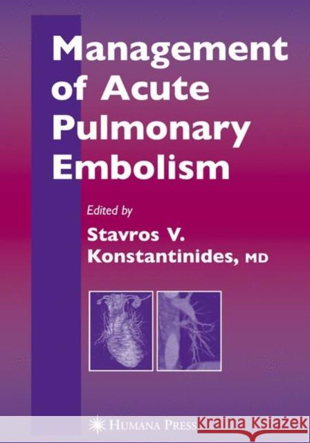 Management of Acute Pulmonary Embolism Stavros Konstantinides 9781617376924