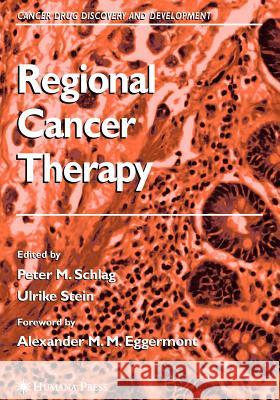 Regional Cancer Therapy Peter M. Schlag Ulrike S. Stein M. M. Eggermont 9781617377112 Springer