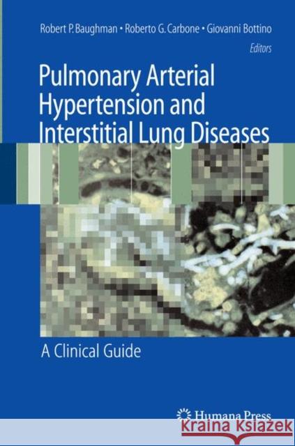 Pulmonary Arterial Hypertension and Interstitial Lung Diseases: A Clinical Guide Baughman, Robert P. 9781617377235