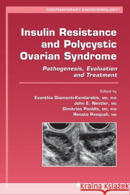 Insulin Resistance and Polycystic Ovarian Syndrome: Pathogenesis, Evaluation, and Treatment Diamanti-Kandarakis, Evanthia 9781617377631 Springer