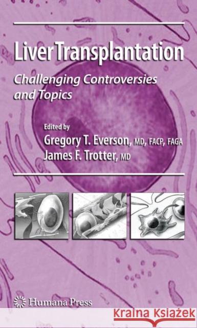 Liver Transplantation: Challenging Controversies and Topics Everson, Gregory T. 9781617377822