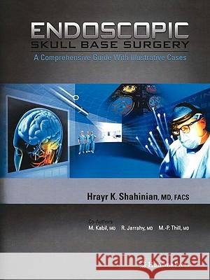 Endoscopic Skull Base Surgery: A Comprehensive Guide with Illustrative Cases Shahinian, Hrayr K. 9781617377907 Springer