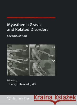 Myasthenia Gravis and Related Disorders Henry J. Kaminski 9781617378058 Not Avail