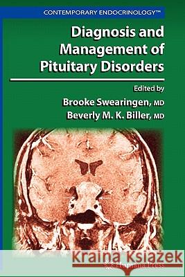 Diagnosis and Management of Pituitary Disorders Brooke Swearingen Beverly M. K. Biller 9781617378461 Springer