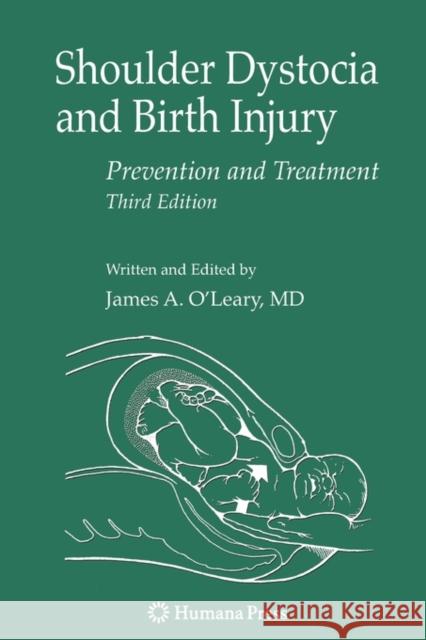 Shoulder Dystocia and Birth Injury: Prevention and Treatment O'Leary, James A. 9781617379277
