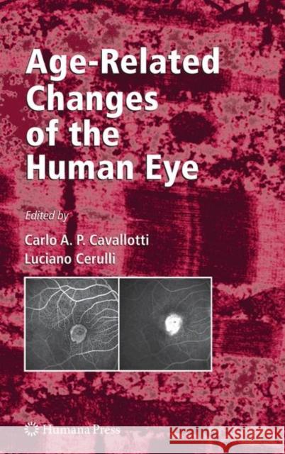Age-Related Changes of the Human Eye Carlo Cavallotti Luciano Cerulli 9781617379369 Springer