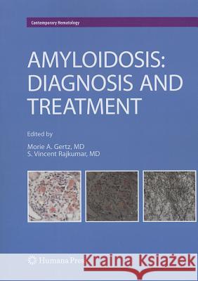Amyloidosis: Diagnosis and Treatment Gertz, Morie A. 9781617796920