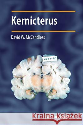 Kernicterus David W. McCandless 9781617797019 Humana Press