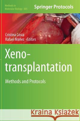Xenotransplantation: Methods and Protocols Costa, Cristina 9781617798443