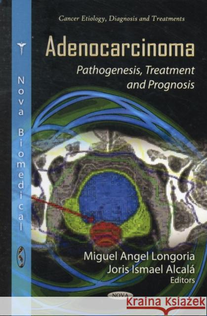 Adenocarcinoma: Pathogenesis, Treatment & Prognosis Miguel Angel Longoria, Joris Ismael Alcalá 9781619421738 Nova Science Publishers Inc