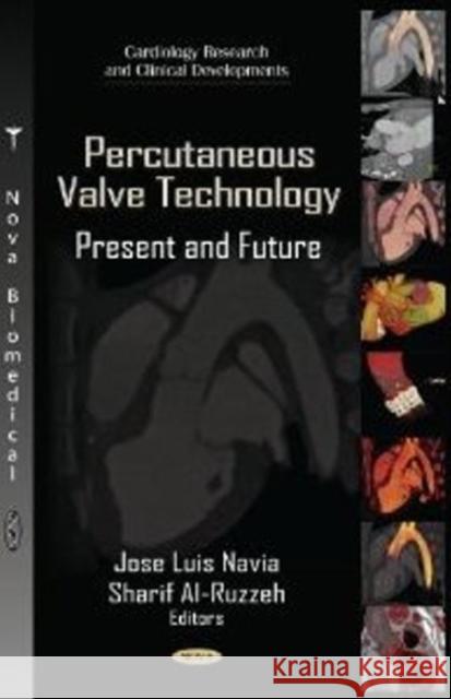 Percutaneous Valve Technology: Present & Future Jose Navia, Sharif Al-Ruzzeh 9781619425774 Nova Science Publishers Inc